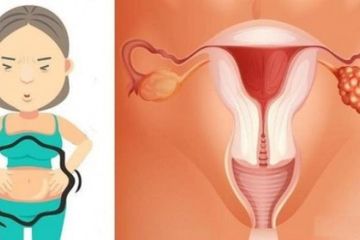 Jangan Dianggap Sepele 10 Tanda Pada Tubuh Ini Jadi Ciri Wanita Terkena Kanker Ovarium Berat Badan Menyusut Hingga Perut Kembung Semua Halaman Hype