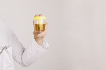 Perubahan warna urine menjadi kuning saat puasa wajar.