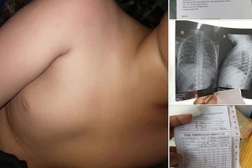 Korban bullying &quot;Jantungnya mau lepas&quot;
