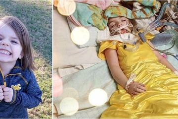 Kisah Pilu Bocah 5 Tahun Penderita Kanker Otak, Minta Didandani Bak Putri Dongeng Sebelum Meninggal Dunia