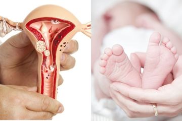 Seorang Ibu Kaget Bukan Kepalang Lihat Bayinya Yang Baru Lahir Sudah Alami Menstruasi Dan Keluarkan Bercak Darah Apa Sebabnya