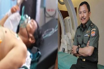 dr Terawan Dokter yang Menangani Wiranto, Menggunakan Angiography dari German Untuk Cuci Otak Pasiennya
