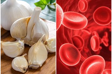 Bawang putih dinilai efektif mencegah risiko keracunan bakteri Campylobacter salah satu pemicu sindrom Guillain-Barre.