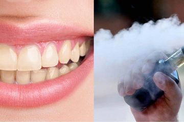 Vape alias rokok elektrik juga bisa membuat gigi kuning.
