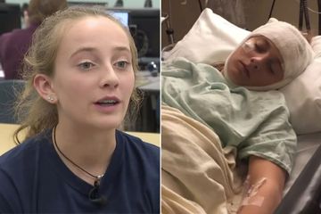 Riley Horner, gadis remaja yang mengalami cedera otak akibat tertendang kepalanya saat berdansa.
