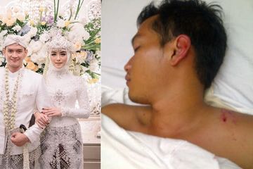 Akui Nikah Tanpa Pacaran, Citra Kirana Sempat Kepergok Temani Rezky Aditya Selama Koma saat Bahu Kanannya Retak