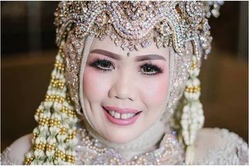 Sering Diejek Tonggos, Elly Sugigi Tak Keluar Uang Sepeser Untuk Rapikan Gigi: 'Ini Gratis Kok'