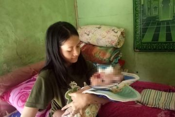 Dina Oktavia dicerai suami karena melahirkan Muhammad Pandhu Firmansyah dengan kondisi hidrosefalus.