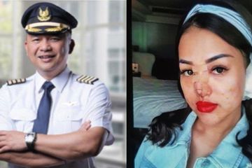 Pramugari Selingkuhan Ari Ashkara Lakukan Operasi Hidung hingga Gigi Kelinci