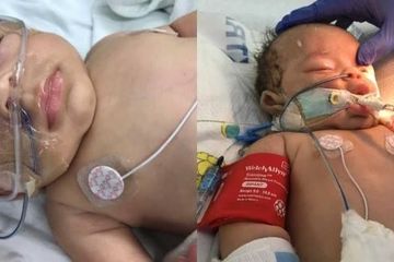 Suami Minta Maaf Hingga Ditangkap Polisi, Gemas Mengguncang Terlalu Keras Sampai Bayi Koma
