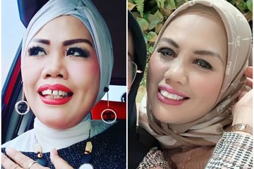Fakta Potong Gigi Elly Sugigi; Menggindari Larangan KPI juga Menghentikan Hinaan, Hingga Hoax Biayanya Hingga Ratusan Juta