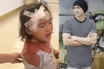 Anak Anji dapat banyak jahitan di pelipis kanan