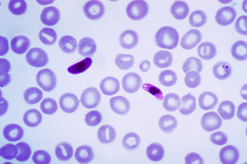 Peneliti Temukan Obat Malaria yang Lebih Efektif Menyembuhkan Penyakit