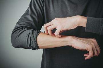 Kulit Gatal Lebih Terasa di Malam Hari, Ternyata Karena Hal Ini