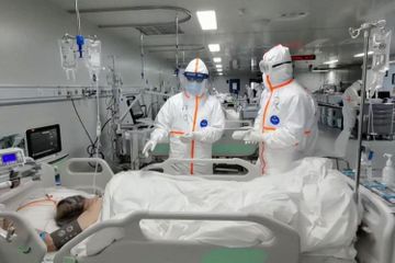 Penyebab paling banyak kematian karena Covid-19 adalah disebabkan oleh respion inflamasi.