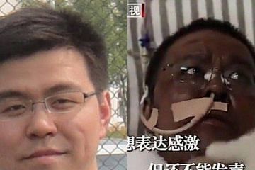 Dr Hu Weifeng (foto di sebelah kiri sebelum jatuh sakit) telah berada di tempat tidur selama 99 hari