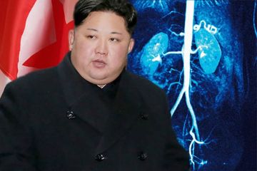 Kim Jong-Un di kabarkan meninggal dunia