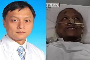 Dr Yi Fan alami kulit terbakar usai sadar dari masa kritis akibat virus corona