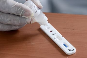 Alat Tes Corona dari China Tak Akurat, 5 Negara Ini Batalkan Pemesanan hingga Minta Uang Kembali