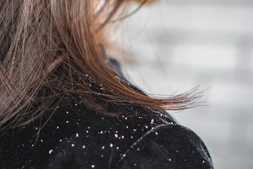 Pilihan Sampo Anti Ketombe Murah Dan Gampang Dicari Biar Pede Nggak Auto Rontok Semua Halaman Otofemale