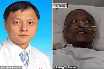 Kondisi Terkini dr Yi Fan, Kulit Menghitam Setelah Terinfeksi Virus Corona, Ternyata Penyebabnya Obat