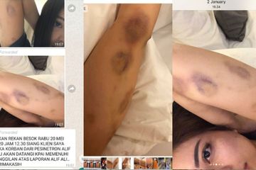 Bukti Aska Ongi digebuki oleh Aliff Alli.