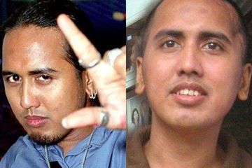 Selama ini Salah Kaprah, Bukan Tumor Otak yang Membuat Gugun Gondrong Lupa Ingatan, Bakteri Inilah Menggerogoti Tubuhnya