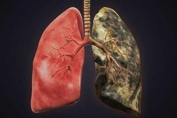 Sudah Sembuh dari Infeksi Covid-19? Awas, Bisa Jadi Corona Hanya Tertidur dalam Tubuh