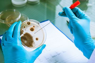 CDC Umumkan Listeria Misterius, Sangat Berisiko pada Ibu Hamil