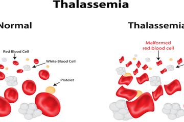 Penyebab Terus Bermunculannya Kasus Baru Thalassemia di Indonesia