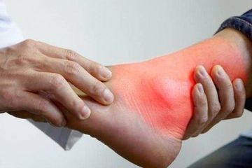 Cek Berapa Kadar Asam Urat yang Normal Untuk Pria dan Wanita