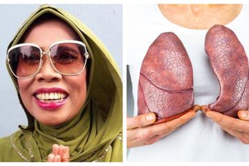(ilustrasi) Meninggal Dunia, Komedian Omas Punya Riwayat Penyakit Komplikasi, 6  Cara Ini Dapat Menjaga Paru-paru Anda Tetap Sehat.