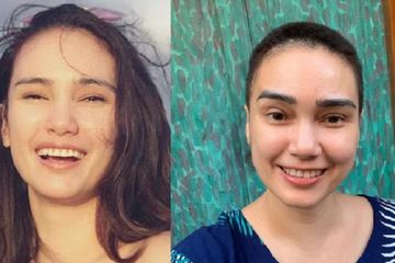 Febby Febiola Jujur Jika Dirinya Pendendam, Sebabkan Kanker Ovarium?