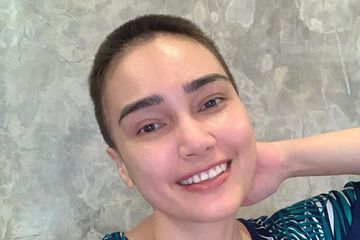 Feby Febiola ceritakan penyebab rambutnya nyaris botak hingga jalani 6 kali kemoterapi