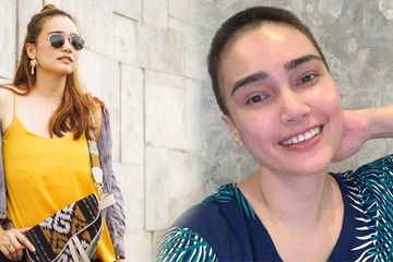 Feby Fabiola mengaku kehilangan rambut karena kemoterapi yang dijalaninya.