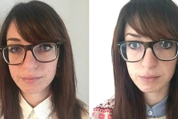 Gina Vaynshteyn, hari kedua dan ketujuh dalam mencoba baking soda sebagai pencuci muka