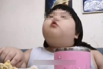 Demi Konten Youtube Balita 3 Tahun Oleh Orangtuanya Dibuat Obesitas, Beratnya Kini 32Kg!