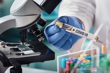 Vaksin Covid-19 yang sudah tahap uji klinis oleh Universitas Oxford di Inggris dan perusahaan farmasi AstraZeneca mengalami penundaan.