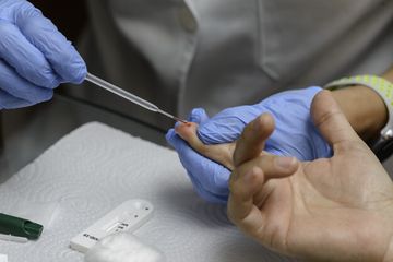Hasil rapid test semuanya palsu dan bukan rekomendasi IDI
