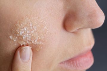 Cobalah Diamkan Larutan Garam Di Wajah Selama 30 Detik Jangan Kaget Lihat Hasilnya Yang Bikin Melongo Semua Halaman Sajian Sedap