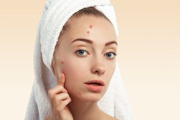 Berita Apa Itu Fungal Acne Terbaru Hari Ini - Stylo