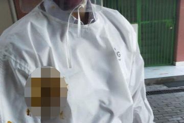 Baju petugas medis yang kena lemparan kotoran manusia oleh istri seorang pasien. 