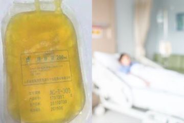 Ngeri Gara Gara Makan Makanan Favorit Sejuta Umat Darah Wanita Ini Berubah Jadi Warna Kuning Dokter Sampai Kaget Lihat Hasilnya Semua Halaman Sajian Sedap