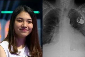 Pemberitaan Meninggalnya Kontestan Indonesian Idol Melisha Sidabutar Salah, Ayah Kandung Bersaksi