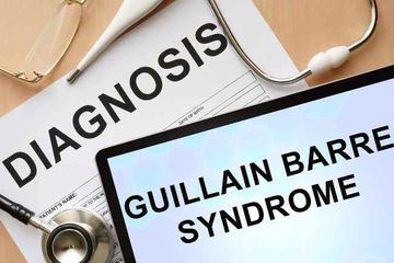 Penelitian menunjukkan tidak adanya hubungan antara Covid-19 dan GBS ( Guillain-Barr&eacute; Syndrome)
