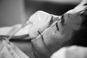 Pria Ini Langsung Kritis Usai Pencet Jerawat di Dagu, Sampai Harus Dirawat di ICU Sebulan