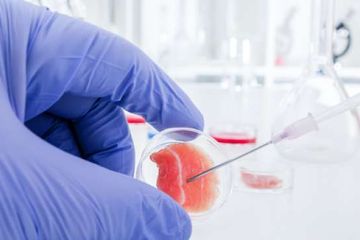 Terapi sel dan gen, salah satu terobosan yang terus dilakukan Bayer untuk melakukan inovasi di bidang kesehatan.