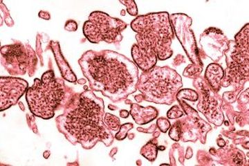 Virus nipah disebut bakal jadi pandemi selanjutnya di Asia