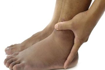 Kadar asam urat tinggi bisa sebabkan berbagai masalah kesehatan, hingga menyebabkan komplikasi.