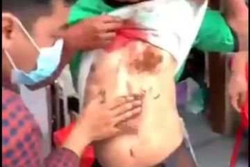 Saksi korban bunuh didi di Gereja Katedral Makassar yang menjadi korban. 